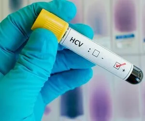 В Минздраве объявили войну гепатиту С