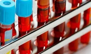 Ученые выяснили, людям с какой группой крови стоит больше опасаться коронавируса