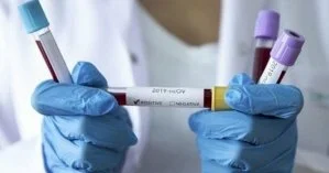 В Украине резко упало число зараженных коронавирусом за сутки: статистика на 28 сентября